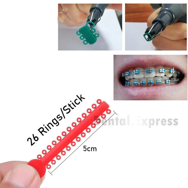 1040 Dental Orthodontic Elastic Ligature Ties Braces Elastomeric Ligating Module gallery