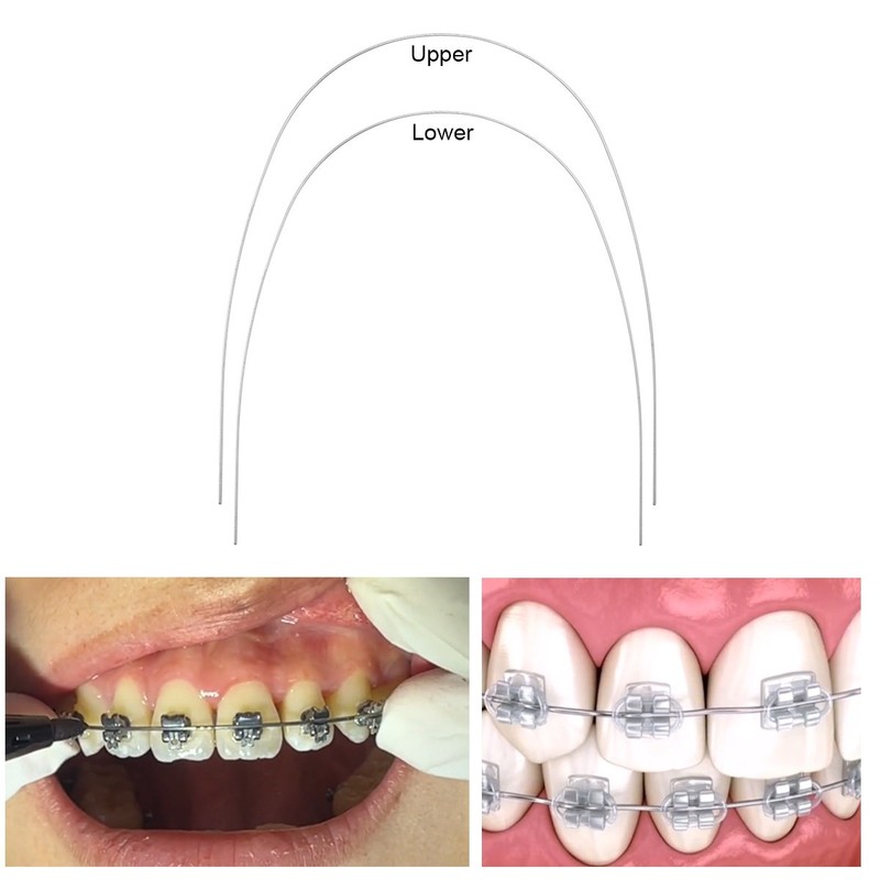 AZDENT Dental Orthodontic Stainless Steel Rectangular Arch Wires Natural Form gallery