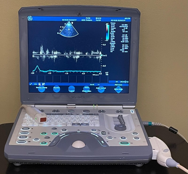 GE VIVID I ULTRASOUND – «ALL OPTION ACTIVE» w/ 02 PROBES (7S-RS and 8L-RS).