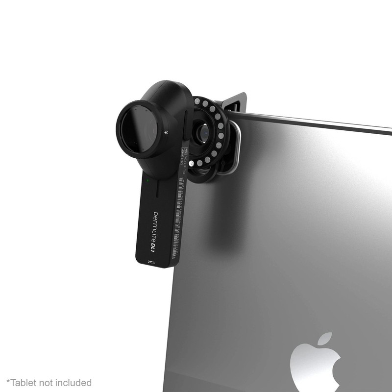 DermLite® DL1 Basic™ Portable Dermatoscope, Polarized, DL1 BASIC gallery