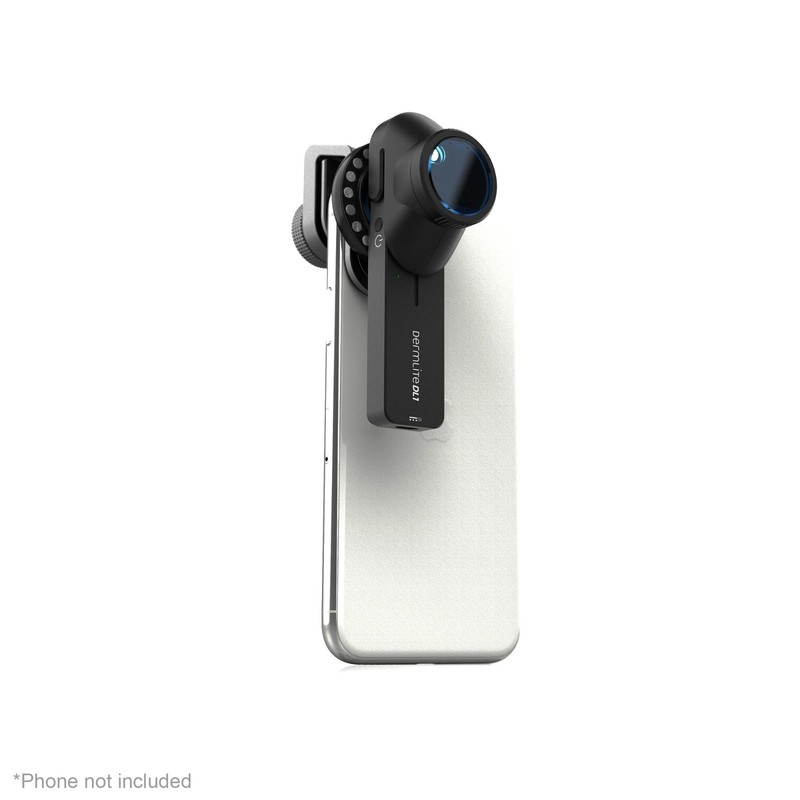 DermLite® DL1 Basic™ Portable Dermatoscope, Polarized, DL1 BASIC gallery