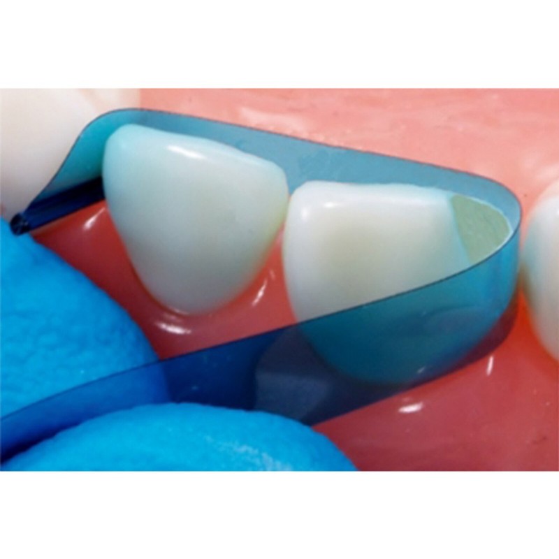 Dental Blue Strip M8 Contoured Anterior Matrix Restoration Matrices 0.05mm gallery