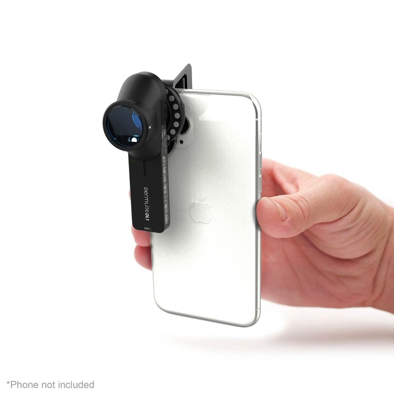 DermLite® DL1 Basic™ Portable Dermatoscope, Polarized, DL1 BASIC gallery