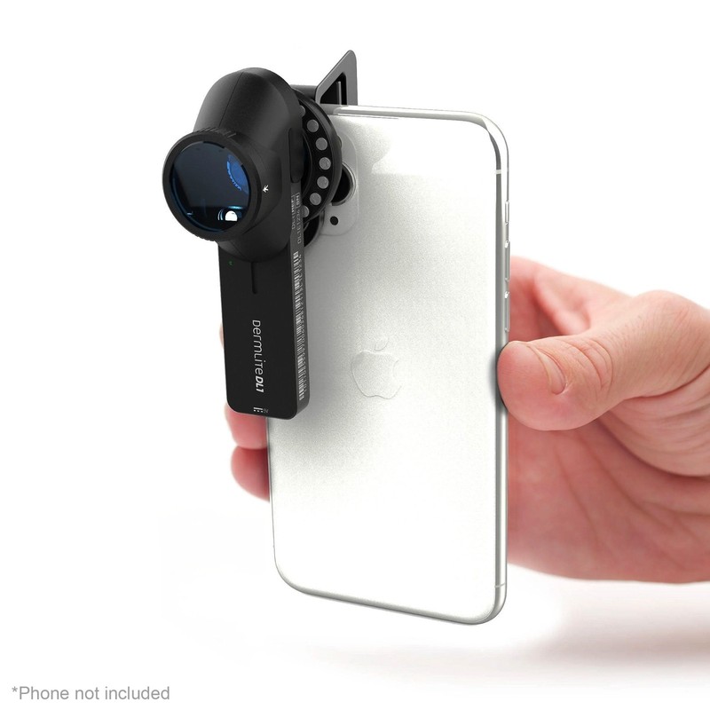 DermLite® DL1 Basic™ Portable Dermatoscope, Polarized, DL1 BASIC gallery