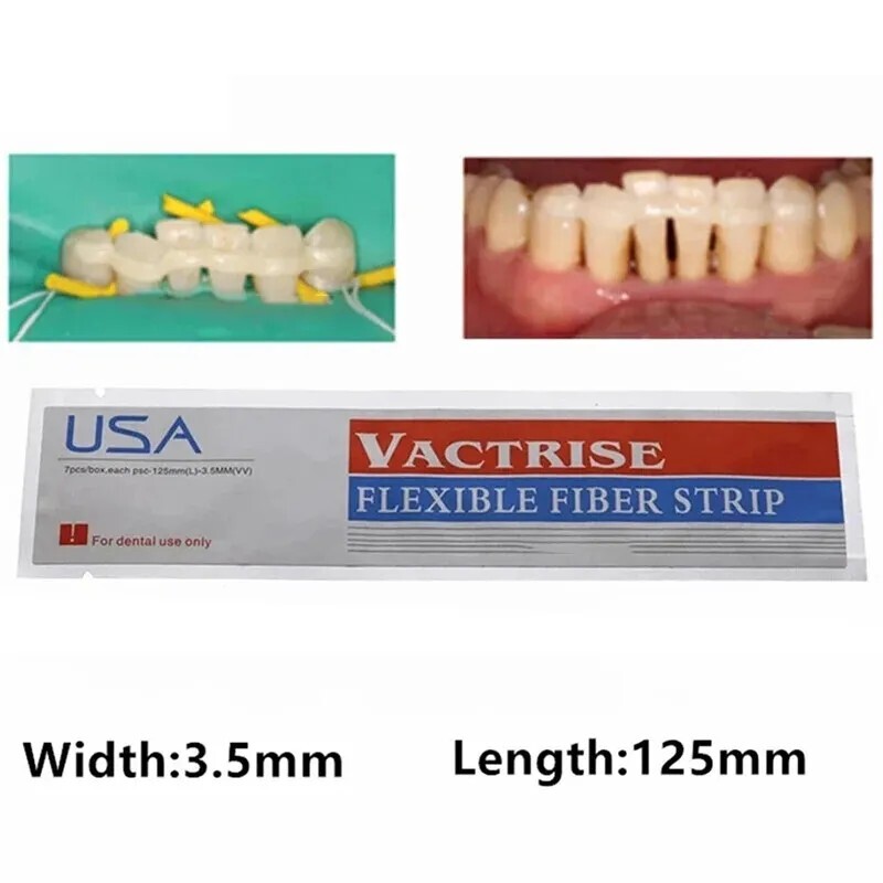 1 Piece Dental Composite Flexible Fiber Strip Glass Fiber Splint Ribbond Ribbon