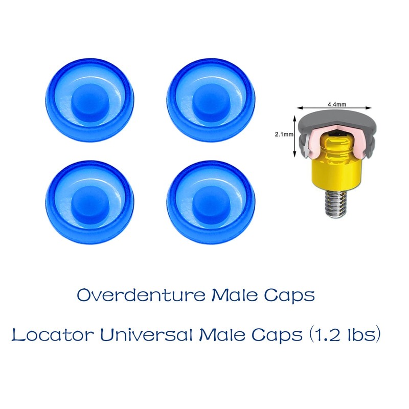 US Dental Locator Overdenture Abutment Retention Cap Male caps Inserts set gallery
