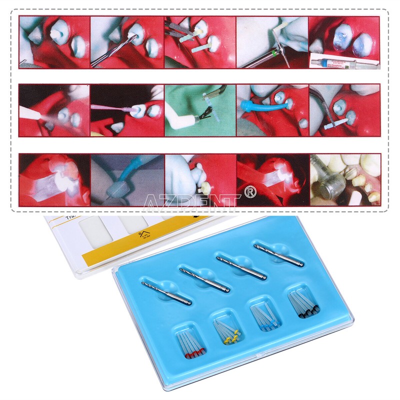 USPS AAA Dental Fiber Post Resin High-intensity Screw Thread Glass +4*Drills FDA gallery