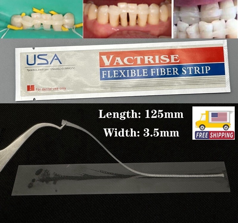 1Piece Dental Composite Flexible Fiber Strip Glass Fiber Splint Ribbond Ribbon