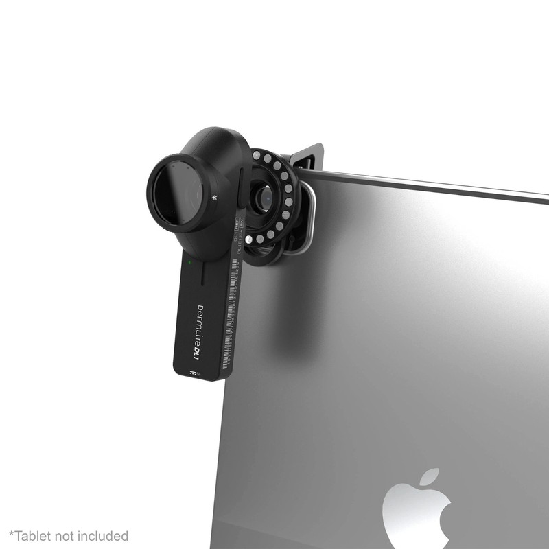 DermLite® DL1 Basic™ Portable Dermatoscope, Polarized, DL1 BASIC gallery